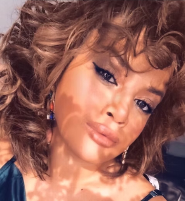 SELENA-